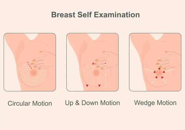 stock vector The three methods to perform a breast self-examination