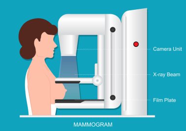 Mammografi ayrıca mastografi DICOM modülü veya MG olarak da adlandırılır..