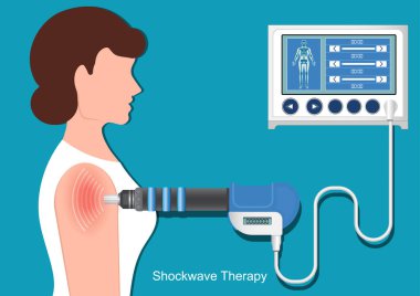 Extracorporeal shockwave therapy treatment . clipart