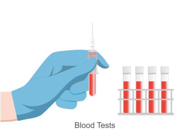 Kan testleri, sağlık hizmeti sağlayıcılarının ölçmek veya incelemek için kullandıkları yaygın testlerdir..