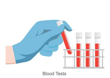 Kan Testleri problemler için geniş spektrumlu bir testtir