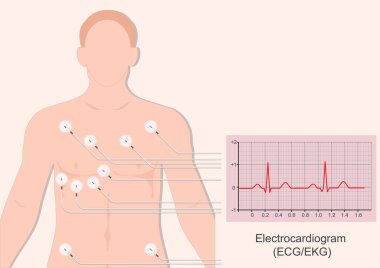 Elektrokardiyogram (EKG) kalp atışını kontrol etmek için hızlı bir testtir. Kalpteki elektrik sinyallerini kaydediyor. Tıbbi sağlık hizmetleri, vektör illüstrasyonu..