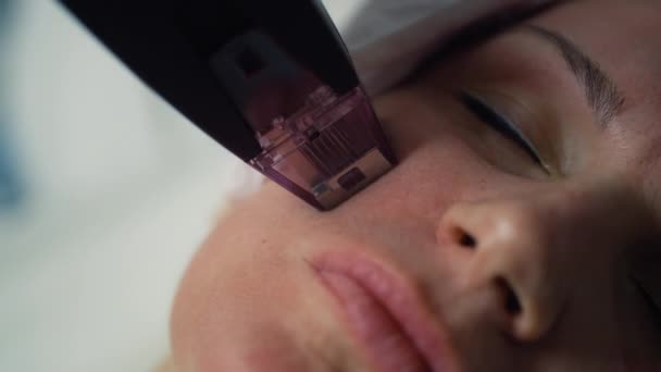 Kosmetolog Sprawia Kobieca Skóra Zaciska Się Igłami Kosmetologia Odmładzająca Zabiegi — Wideo stockowe
