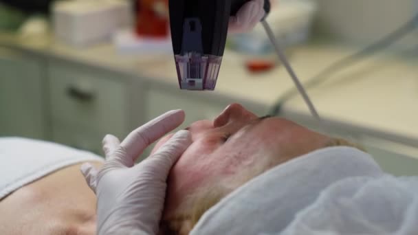 Cosmetologist Executa Levantamento Microagulha Uma Mulher Sênior Pele Facial Apertando — Vídeo de Stock