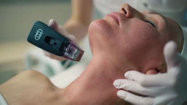 Advanced Skin Rejuvenation Fractional Radiofrequency System Zur Präzisen Und Effektiven — Stockvideo