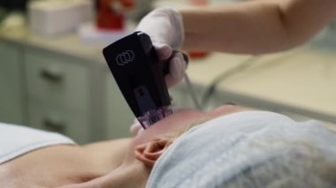 Yüz Teni Yenileme Tedavisi: Genç Görünümü için Deneyimli Kozmetik Uzmanı tarafından Micro-Needling Lift prosedürü. Yüksek kalite 4k görüntü