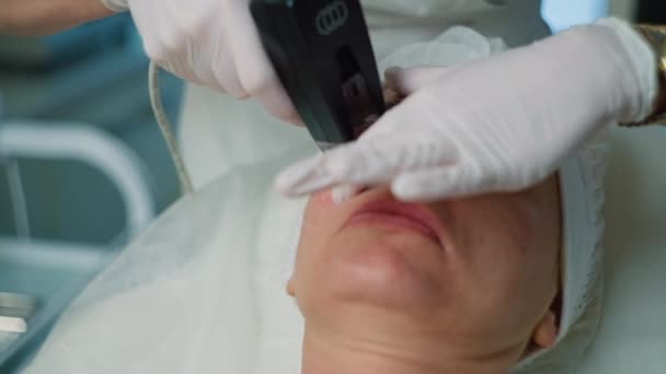 皮膚の健康を変える 非外科的な顔の持ち上がりおよび皮の再生のためのマイクロニードルRfシステム 高品質の4K映像 — ストック動画