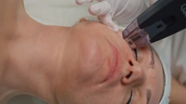 Devrimci Yüz Yenileme: RF Denetimli Cilt Yenileme ve Yaş Tersine Çevirme İçin Mikrodalgalandırma. Yüksek kalite 4k görüntü