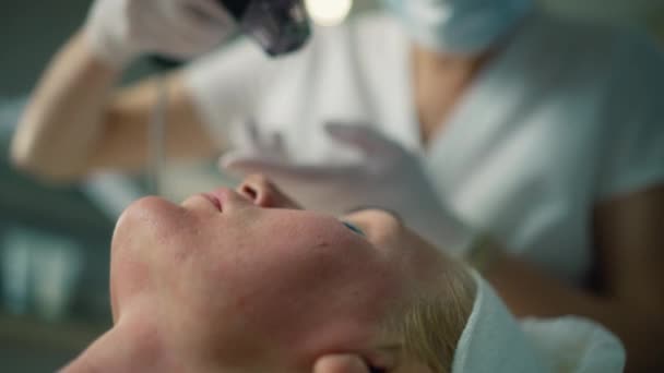 정확한 Hyperpigmentation 확대된 숨구멍의 효과적인 처리를 고주파 고품질 — 비디오