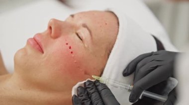 Yetenekli bir kozmetolojistin cilt yenilemesi. Kırışıklıkları yumuşatmak için şırınga kullanması, cildini sıkması ve güzellik tedavisinde görünüşünü iyileştirmesi. Yüksek kalite 4k görüntü