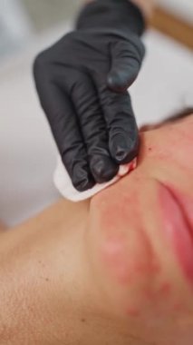 Güzellik prosedürü: profesyonel bir kozmetolog cilt gençleştirme ve yaşlanmayı önleyici tedaviler için yüz enjeksiyonları uygulamak için bir şırınga kullanıyor. Yüksek kalite 4k görüntü