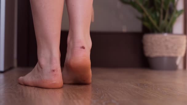 女人的脚因为鞋子不舒服而起泡足部护理概念强调适当的鞋类对足部健康的重要性 — 图库视频影像