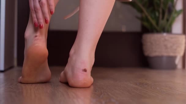 Ampollas Los Pies Una Mujer Debido Zapatos Incómodos Concepto Cuidado — Vídeos de Stock