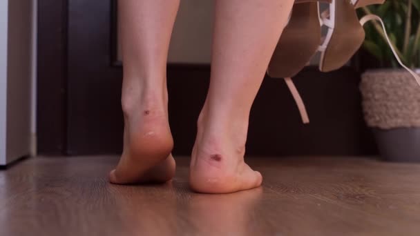 Ampollas Los Pies Una Mujer Debido Zapatos Incómodos Concepto Cuidado — Vídeo de stock