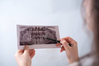 X-ray görüntülemesi ile ilgili diş hastalıklarının teşhisi tedavi ve önlemede önemli bir adımdır.