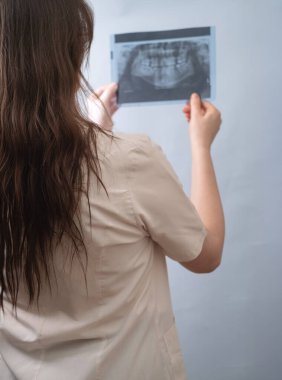 Diş hekimliğinde röntgen, doğru diş sağlığı değerlendirmesi için modern tanıların temel bir parçasıdır..