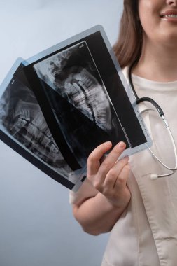 Kadın dişçi, hastanın diş durumundaki değişiklikleri değerlendirmek için iki röntgen görüntüsünü inceler..