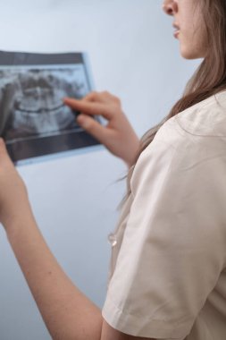 Diş hekimi tedavi sürecini değerlendirmek ve potansiyel sorunları belirlemek için X-ray resimlerini karşılaştırır.