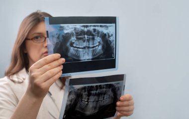 Hastanın röntgenlerini karşılaştırarak dişçi değişiklikleri analiz eder ve en iyi tedavi stratejisini seçer..