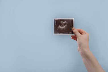 Kadın doğum uzmanı ve jinekolog ultrason görüntülerini inceleyerek modern tedavi ve hamilelik planlama seçenekleri sunuyorlar..