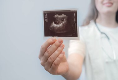 Kadın doğum uzmanı hastaya danışıyor. Etkili hamilelik planlaması için ultrason sonuçlarını değerlendiriyor..