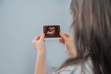 Kadın doğum uzmanı ve jinekolog, tüp bebek olasılıkları hakkında danışmanlık yaparak ultrason görüntüsü elde etti..
