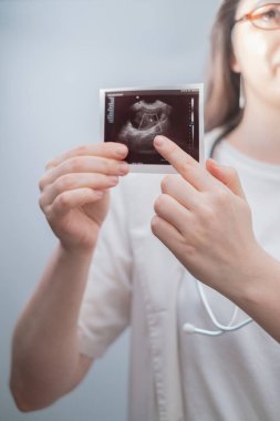 Kadın doğum uzmanı, ultrason görüntülerini inceleyerek ve bir gebelik planı sunarak hastalara annelik yolculuklarında yardımcı oluyor..