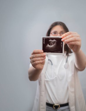 Deneyimli kadın doğum uzmanı-jinekolog bir kadının ultrason sonuçlarını yorumlamasına yardımcı olur ve sonraki adımları detaylara dikkat ederek tavsiye eder..