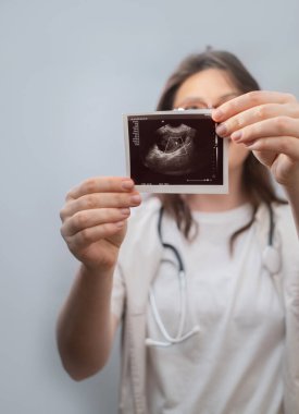 Doğum uzmanı-jinekolog ultrason sonuçları gösteriyor ve kısırlık tedavisi ve üreme sağlığının iyileştirilmesi hakkında tavsiyelerde bulunuyor.