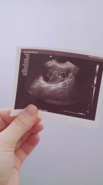 Doğum uzmanı-jinekolog, ultrason sonuçlarını hastaya göstererek, tedavi seçeneklerini ve gebelik için destekleyici yöntemleri açıklıyor. Yüksek kalite 4k görüntü