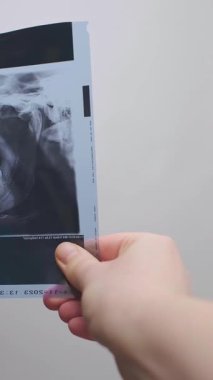 Kadın dişçi, hastalarının röntgenlerini analiz eder. Diş çürükleri, iltihaplanma ve diğer diş durumlarını tespit eder. Yüksek kalite 4k görüntü