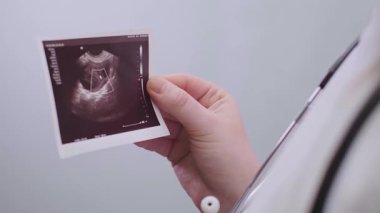 Kadın doğum uzmanı ultrason sonuçlarını hastaya açıklayarak gebelik ve vitamin tedavisi için ideal yöntemler sunuyor. Yüksek kalite 4k görüntü