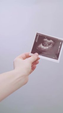 Doğum uzmanı-jinekolog hastaya ultrason kullanarak kişiselleştirilmiş bir tedavi planı hazırlıyor ve hamileliğe hazırlanıyor. Yüksek kalite 4k görüntü
