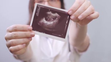 Kadın doğum uzmanı-jinekolog hastaların ultrason görüntülerini kullanarak hamileliklerini planlamalarına yardımcı oluyor. Yüksek kalite 4k görüntü