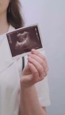 Kadın doğum uzmanı-jinekolog, tüp bebek gibi ultrason ve modern tedaviler kullanarak hastaya hamilelik yolunda yardımcı oluyor. Yüksek kalite 4k görüntü