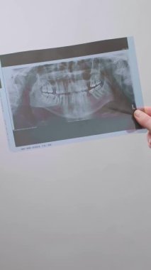 Diş hekimi röntgen görüntüsünü tutuyor ve teşhis ve tedavi için hastaların dişlerinin durumunu değerlendiriyor. Yüksek kalite 4k görüntü