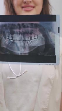 Doktor, diş tedavisi için bireysel bir yaklaşım seçmek için hastaların röntgenlerini inceler. Yüksek kalite 4k görüntü