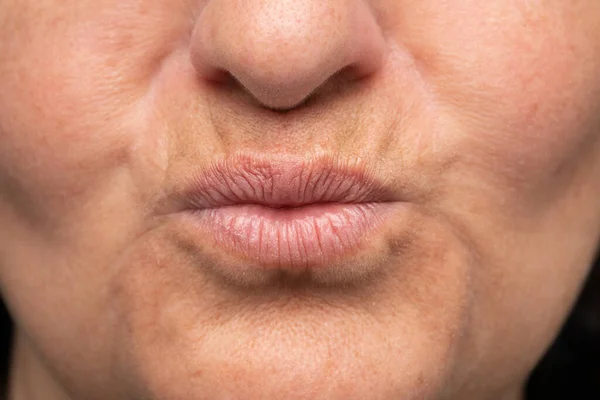 Closeup Mouth Mature Woman Aged Lip Problem Wrinkles Signs Aging — Stock Photo, Image