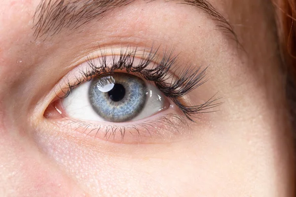 Zbliżenie Niebieskie Oko Dziewczyny Czerwonymi Włosami Koncepcja Chorób Oczu Wzroku — Zdjęcie stockowe