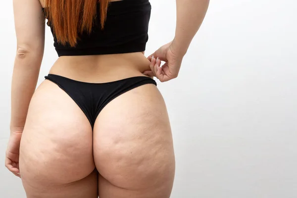 一个无法辨认的肉质女人的后背 同时在臀部和大腿上用纤维素接触脂肪的褶皱 曲线女子与青少年情结的美感与体形 — 图库照片