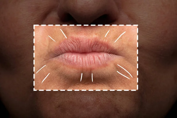 女性の口の中で表現ライン 高齢者の唇が強調した 口のしわの老化ライン — ストック写真