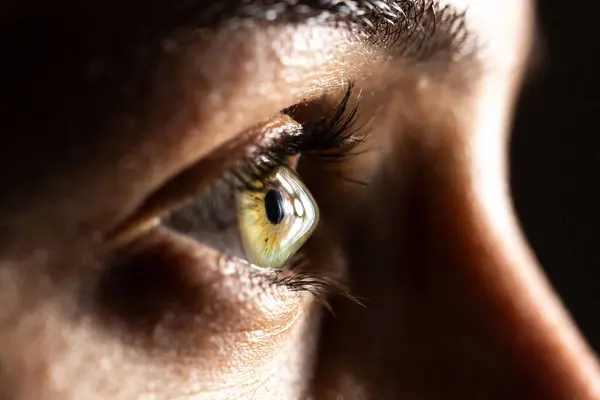 Макро Ясного Женского Глаза Белой Женщины Страдающей Кератоконусом Конусная Деформация Лицензионные Стоковые Изображения