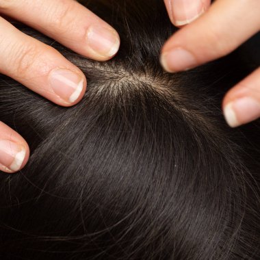 Detaylı bir kafa tetkiki bir çocuğun saçının detaylarını ortaya çıkarır, bitleri kontrol eder.