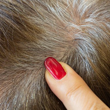 Bir parmağın yakın plan görüntüsü boyalı saçların köklerinde yeniden uzayan belirgin beyaz saçlara işaret ediyor.