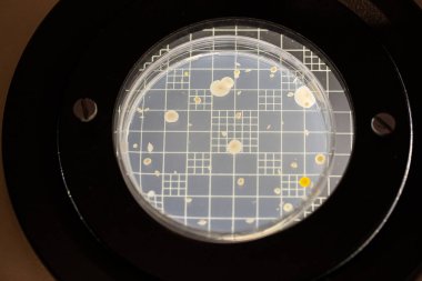 Laboratuvar ortamında bakteri kolonilerinin büyümesini gösteren bir petri kabı, bilimsel ve tıbbi araştırmalar için kullanışlı