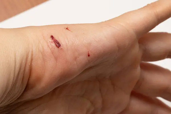 stock image Close-up of a minor cut on the back of a hand, showcasing a small injury and highlighting skin damage