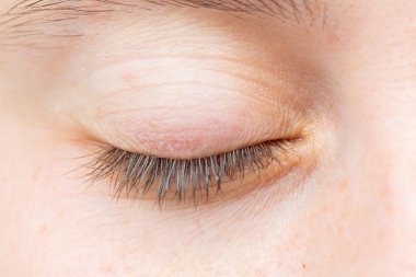Kirpik kaldırma tedavisinden sonra gözlerini kapatan bir kadın kısa kirpiklerini gösteriyor.
