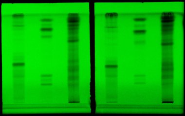 Protein elektroforezi, bilimsel bir laboratuvar ortamında UV aydınlatması altındaki protein bantlarını ortaya çıkarıyor.