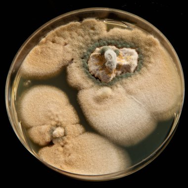 Bir mikrobiyoloji laboratuvarı deneyi sırasında, bir petri kabında büyüyen ve ilginç desenler oluşturan farklı küf tipleri.