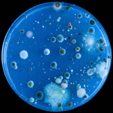 Mavi bir tarlada petri kabının içinde büyüyen farklı mikrobik koloniler.
